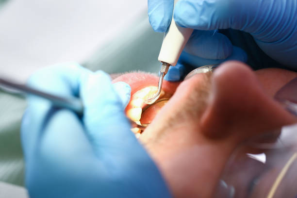Best Knocked-Out Tooth Emergency  in Grand Canyon Village, AZ